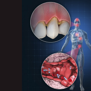 The Interrelationship Between Nutrition and Oral Health and the Impact of Diabetes eBook Thumbnail