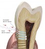 Figure 4  NovaMin particles clean, desensitize, and remineralize dentin to create a smoother surface that is less plaque- and stain-retentive.