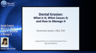 Dental Erosion: What Is It, What Causes It, and How to Manage It Webinar Thumbnail