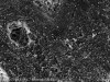 Fig 3. Scanning electron microscope (SEM) images of the dentin carious lesions. Fig 3: Surface morphology of arrested carious lesion. Fig 4: Surface morphology of active carious lesion. (images from Mei, et al, 201421 [reprinted with approval])