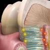 Fig 1. Depiction of fluid movement through open dentin tubules, which causes pain. Stimuli on exposed dentin (indicated by bright yellow spots) cause fluid movement in tubule. Fluid travels through tubules (indicated by white arrows) and excites nerves.