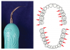 (3.) Use of right curved ultrasonic insert. Image retrieved from Gehrig et al.